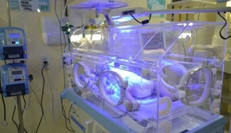 Mortalidade neonatal contrai em 40% na Maternidade.