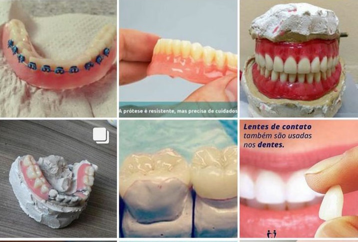 Divulgação do Auxiliar de Prótese Dentária.