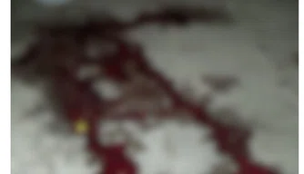 Moradora de rua é morta a facadas na zona Norte de Teresina