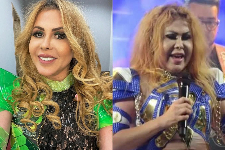 Cantora Joelma cancela shows após diagnóstico de esofagite, gastrite e edema