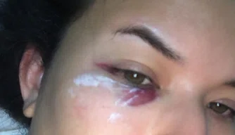 Jornalista denuncia agressão