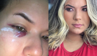 Jornalista denuncia agressão